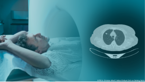 Lungenkrebs-Screening – Fortbildung zur Qualifizierung für die Erstberatung gemäß § 43 Abs. 2 KFE-RL